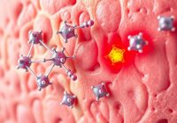 Reakcje alergiczne na kwas hialuronowy – objawy, przyczyny i leczenie Reakcje alergiczne na kwas hialuronowy – objawy, przyczyny i leczenie